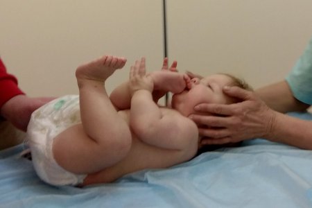 Остеопатия и повреждение ключицы новорожденного