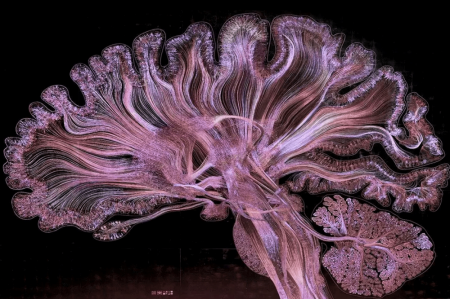 Фантастические снимки головного мозга в фотопроекте «Самоотражение