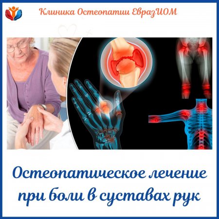 Остеопатическое лечение при боли в суставах рук